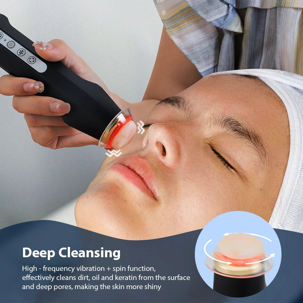 Foreverlily Oxygen Bubble Pen Facial CO2 Treatment Device