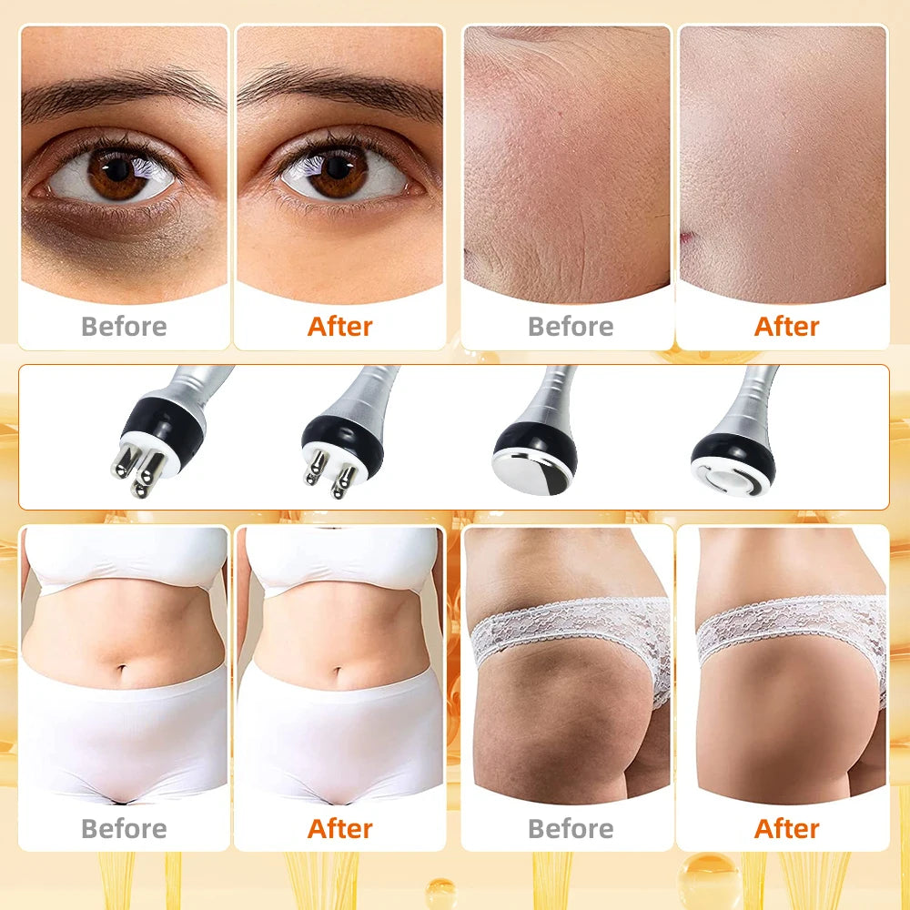 4 IN 140K Cavitation Ultrasonic Body Slimming Machine  Beauty Device Facial Massager Skin Tighten Face Lifting Vacuum Suction